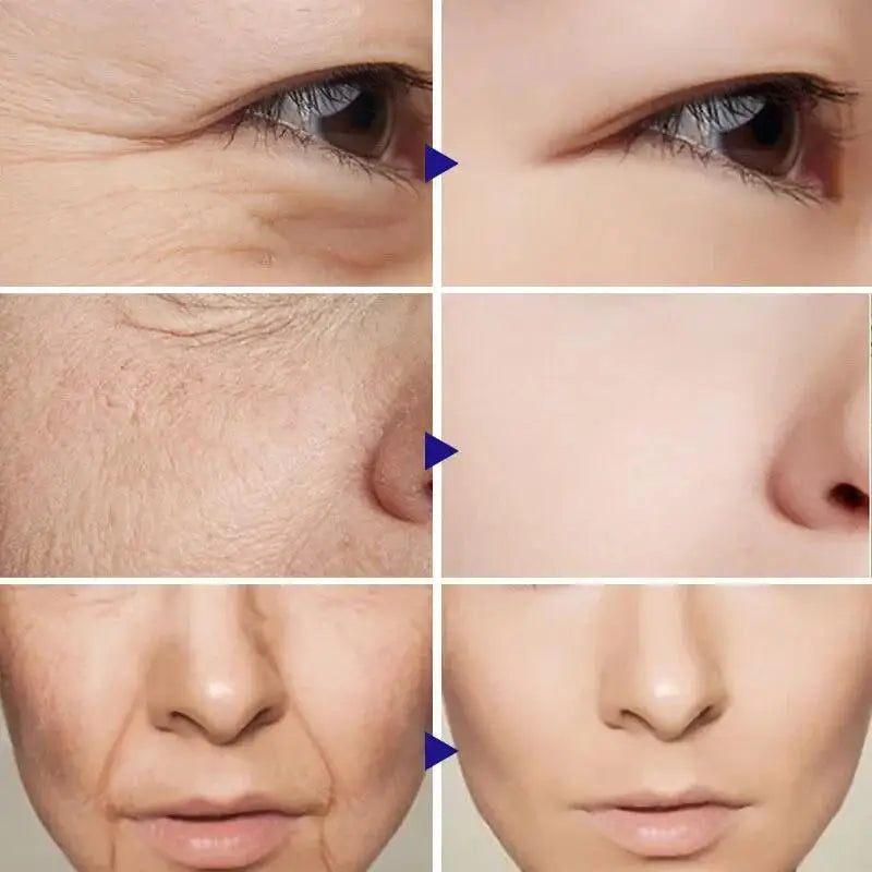 Retinol Firming Serum Set